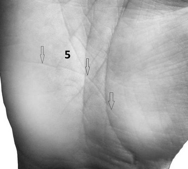 Линия виа ласцива на руке фото с расшифровкой
